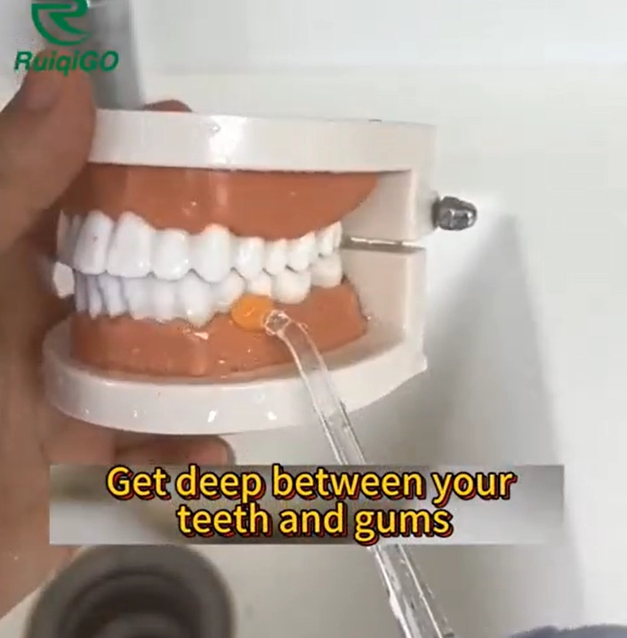 use Oral Irrigator